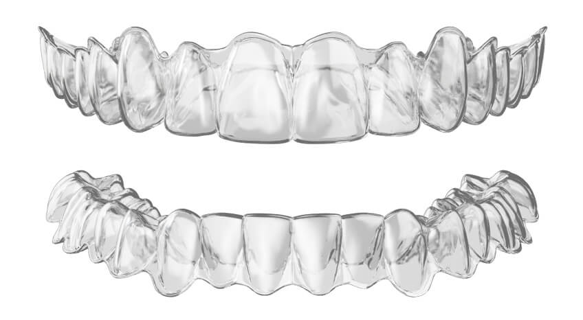What you need to know about aligners