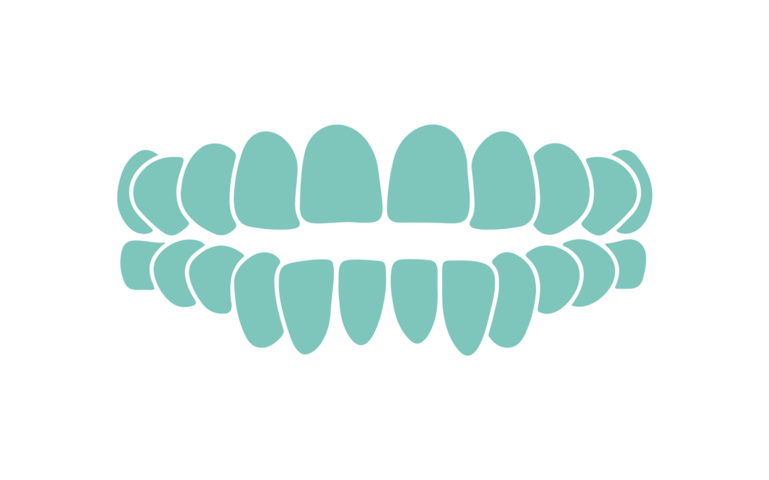 Si trajtohet kafshimi i hapur (OPEN BITE)?